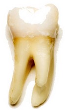 Toothregenerationgell