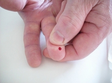 New finger prick test holds promise for detecting cancer