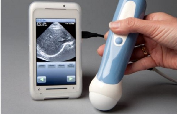 MobiUS SP1 System – a smartphone ultrasound that can fit in your pocket