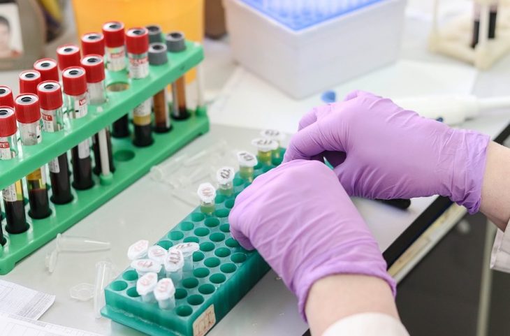 PanSeer – new blood test may be able to detect cancer four years before symptoms appear